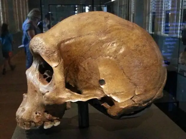 Череп Кабве, или череп из Брокен-Хилла, с отверстием, похожим на пулевое, выставлен в Национальном историческом музее в Лондоне. 