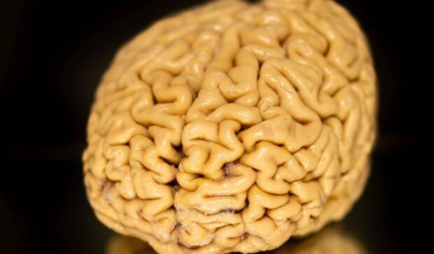 Как мозг «суперэйджеров» обходит старение: нейрогенез как возможная защита от деменции