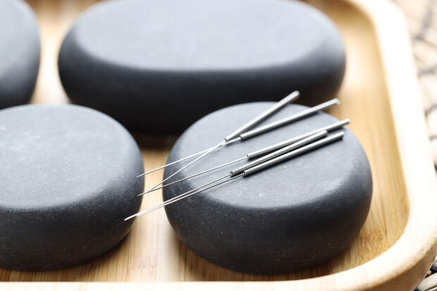 Иглорефлексотерапевт Паршин: лучше всего иглы снимают боли шеи и поясницы