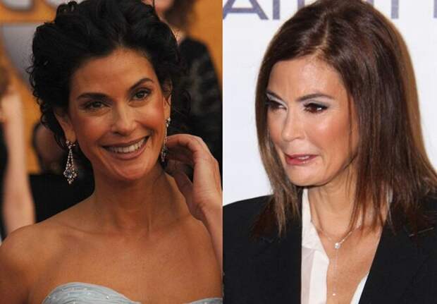 Знаменитости и их обновлённые лица