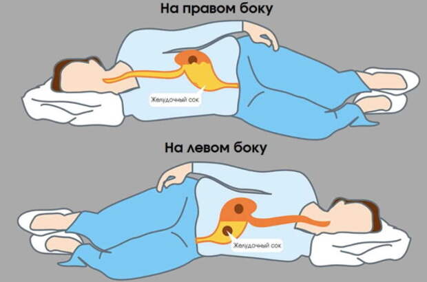 На правом боку спать опаснее