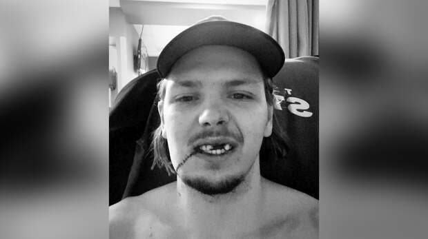 "Джокер": Российскому хоккеисту разорвало рот во время матча в США