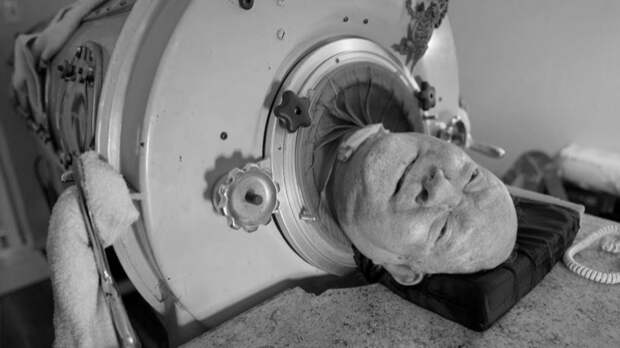 «Человек в железном легком»: умер проживший более 70 лет в капсуле мужчина