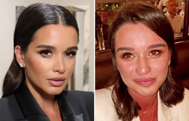 Иллюзия совершенства: Как 43-летняя Бородина выглядит на 25, а 70-летняя Долина «не стареет» в кадре, но что скрывают фильтры