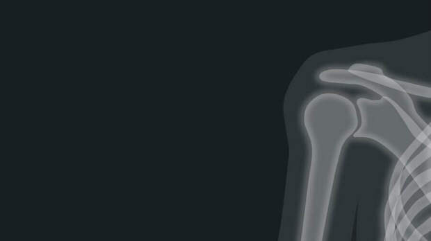 medical AI