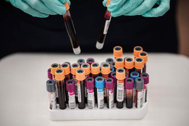 Союз страховщиков: туберкулез и СПИД не входят в программу ОМС