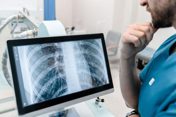 Ученый из МФТИ Кузьмин: три главные причины мешают нам победить туберкулез