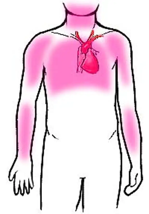 Как болит сердце картинки