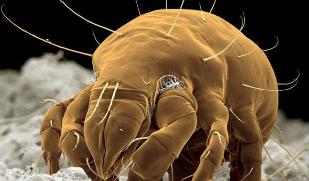 5 ужасных микроорганизмов, которые живут рядом с нами