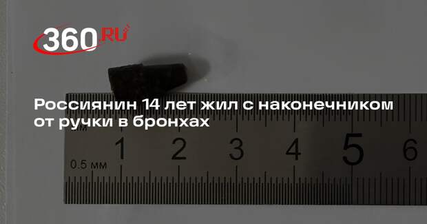 Россиянин 14 лет жил с наконечником от ручки в бронхах