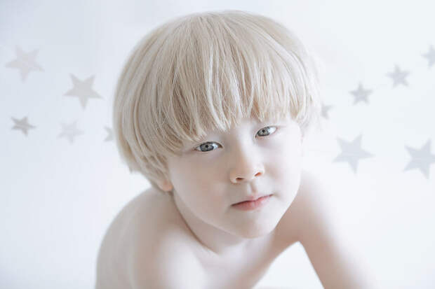Шмулик альбиносы, красота, люди, фото, фотограф, фотопроект, цвет кожи