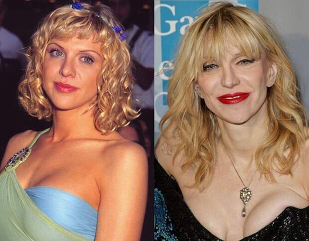 Знаменитости и их обновлённые лица