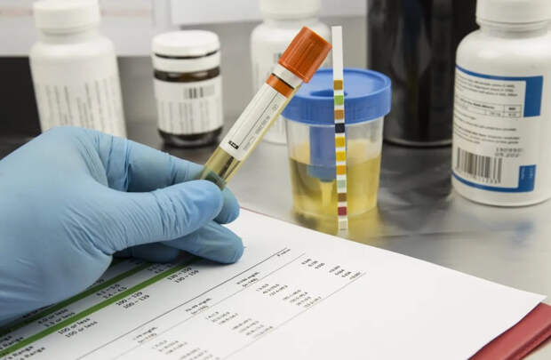 Цвет мочи как индикатор здоровья — что важно знать каждому