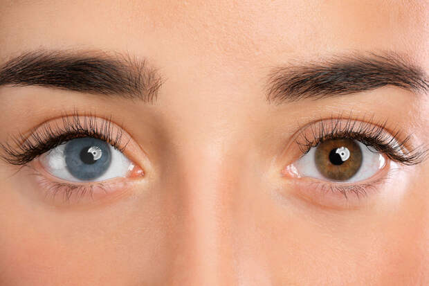 Врач Левина: меланома может вызвать изменение радужной оболочки