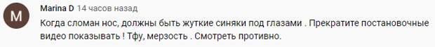 Телезрители заподозрили Собчак в пластике носа под сомнительным предлогом