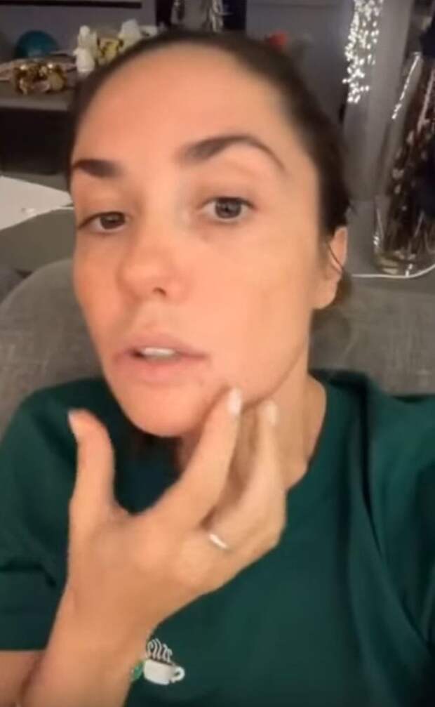 «Решила проколоться»: Агата Муцениеце показалось перед публикой в синяках