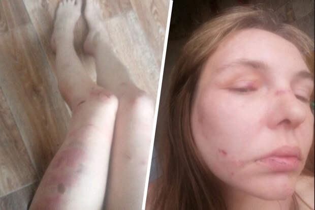 В Пермской области женщина обвинила сожителя в пытках электрошокером