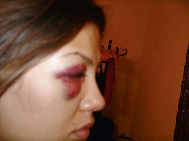 Скандальные фото Виктории Бони Скандальные фото Виктории Бони