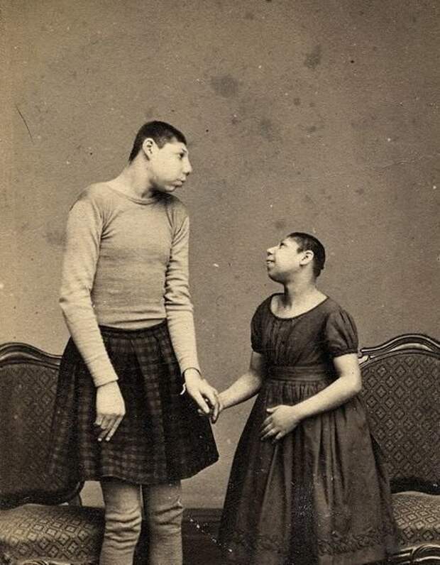 3. Хомио и Лола, дикие дети Австралии, 1885 интересно, история, люди-мутанты, мутации, прошлое, фото