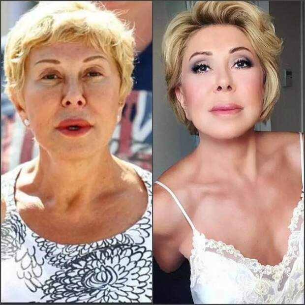 Любовь Успенская до пластики и после