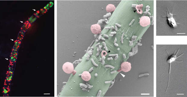 Чтобы стать грибами, одноклеточные афелиды потеряли подвижность и способность к фагоцитозу