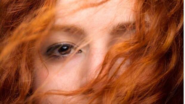 Рыжим приходится недегко: огненный цвет волос сопровождается и нестандартным отношением к обезболивающим