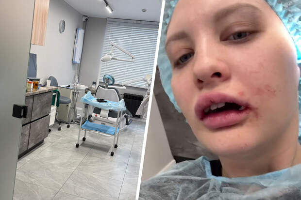 Певица Королева похвалила невестку за стойкость после операции на челюсть