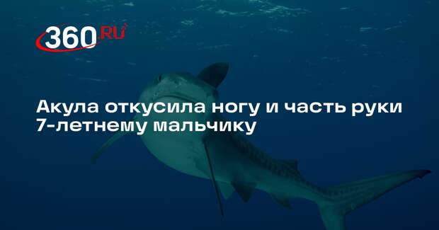 Акула откусила ногу и часть руки 7-летнему мальчику