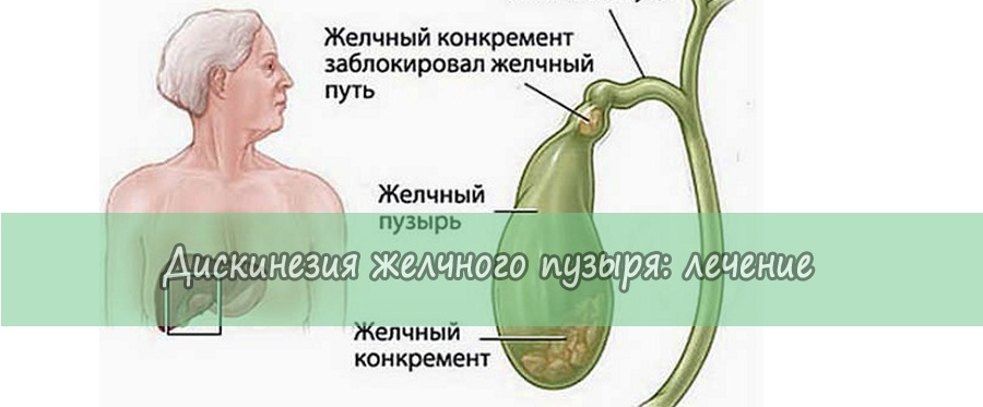 Желчный пузырь лечение фото