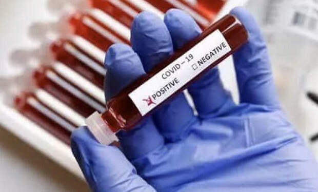 В ВОЗ признались в неведении по поводу ситуации с COVID-19