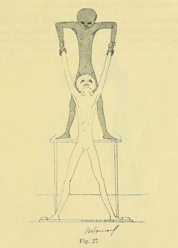 lechebnaya-gimnastika-v-ginekologii-po-Ture-Brandtu-illyustratsii 10