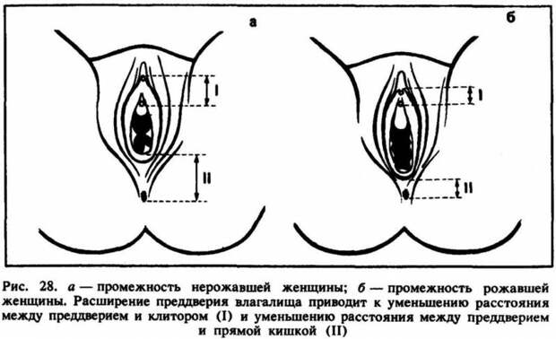 Пластика клитора: назначение, алгоритм работы, время проведения, показания, специфика процедуры, необходимые инструменты и последствия пластики