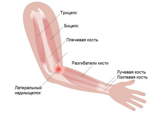 Хруст в локтевом суставе: причины, лечение, профилактика