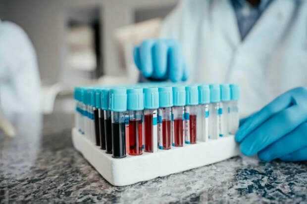Врач Карасев рассказал, когда нужно сдать анализы крови
