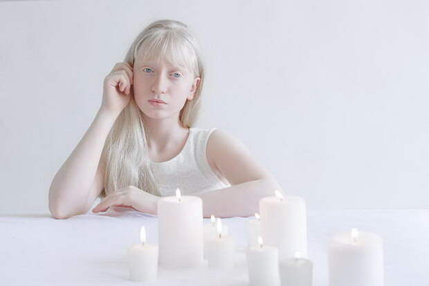 Красота альбиносов в фотографиях Yulia Taits Красота альбиносов в фотографиях Yulia Taits