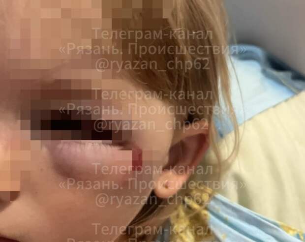 Прокуратура проводит проверку по факту травмирования 5-летнего ребенка электросамокатом в Рязани