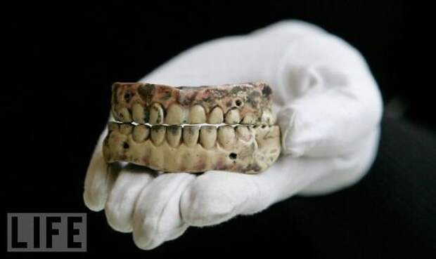 Зубные протезы XIX века Зубы, Зубные протезы, История медицины, 19 век, Длиннопост