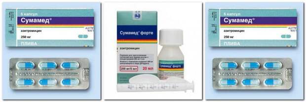 Какой кашель при бронхите: симптомы, методы лечения, особенности протекания болезни