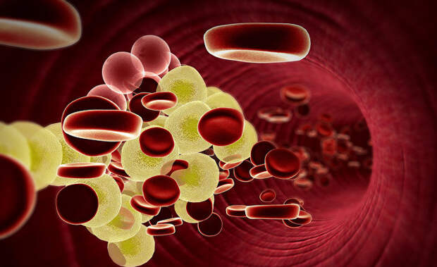 Повышенный холестерин: ежедневное использование пластика вызывает серьёзные сердечно-сосудистые заболевания (Daily Express, Великобритания)