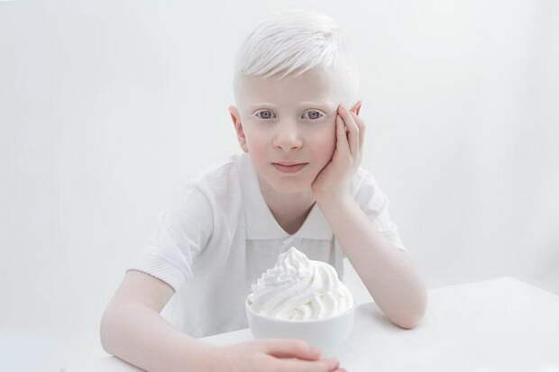 Красота альбиносов в фотографиях Yulia Taits Красота альбиносов в фотографиях Yulia Taits