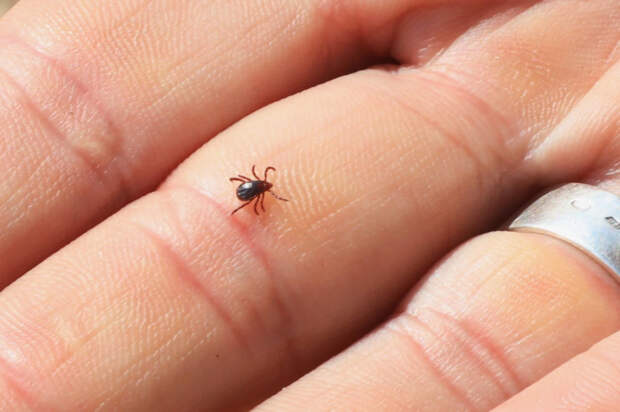 Срочно к врачу: как распознать клещевой энцефалит на ранней стадии после укуса кровососа