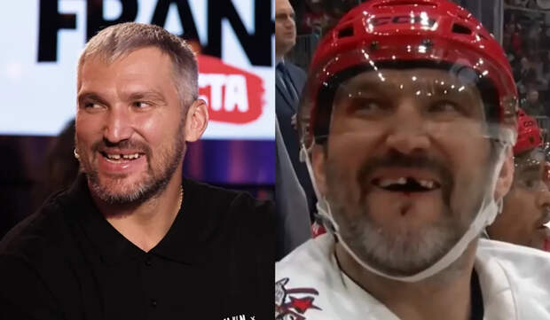 Овечкину выбили еще один зуб! Просто посмотрите на эту улыбку — Овечкин live