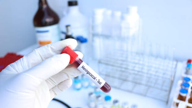 Врач Чернышова рассказала об осложнениях менингококковой инфекции