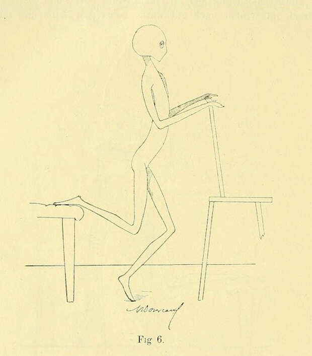 lechebnaya-gimnastika-v-ginekologii-po-Ture-Brandtu-illyustratsii 3