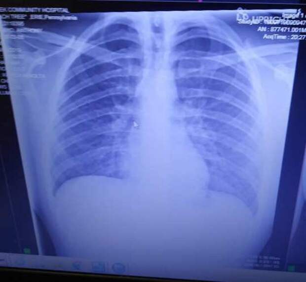 https://360tv.ru/media/uploads/article_images/2019/09/48350_lungs-af98.jpg