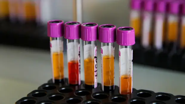 В Татарстане за сутки выявили 57 новых случаев COVID-19