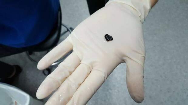 Австралийка потратила 500 долларов на операцию 12-доллоровой золотой рыбке (7 фото)