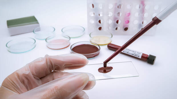 Анализы крови, которые спасут жизнь: 3 примера