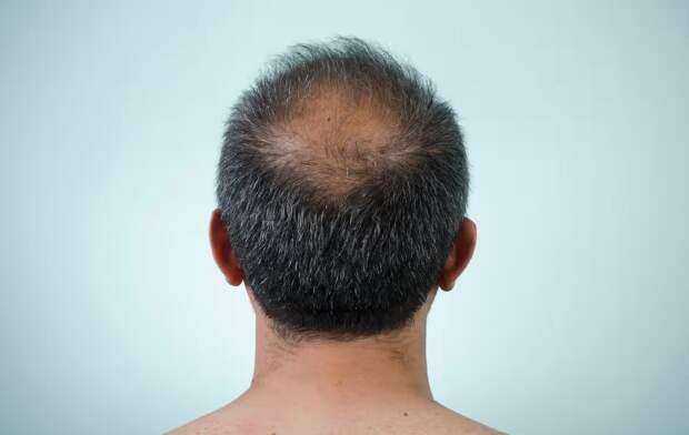 Прорыв в дерматологии: в лаборатории впервые вырастили полнофункциональные волосяные фолликулы