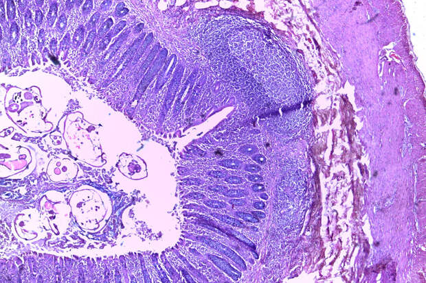 Россиянам объяснили пользу заражения глистами